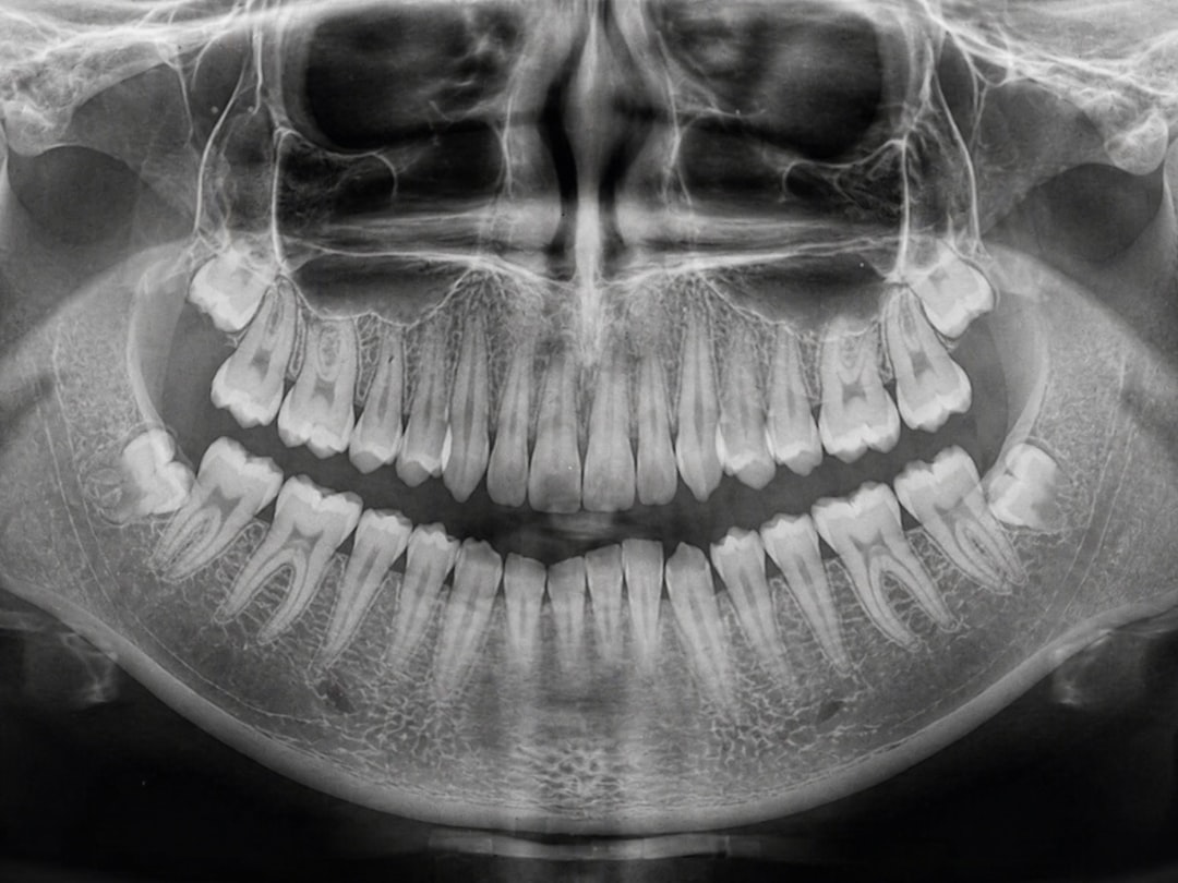 Bone grafting procedure at DC Pearls
