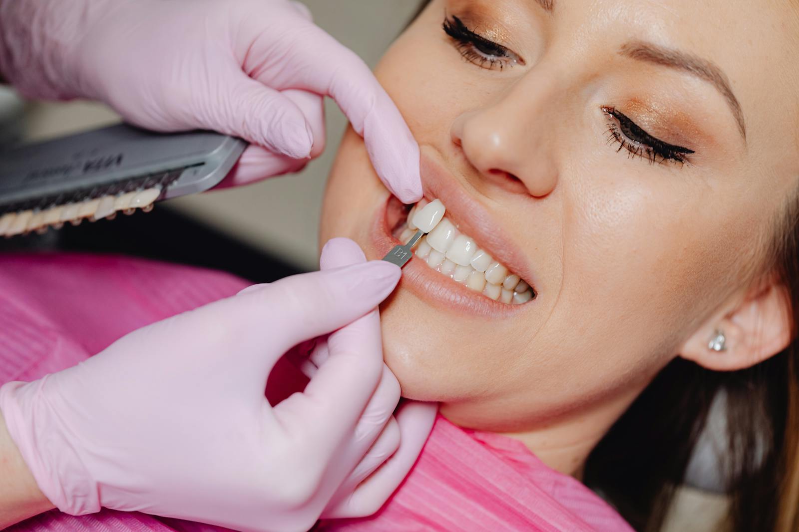 Crown lengthening procedure at DC Pearls