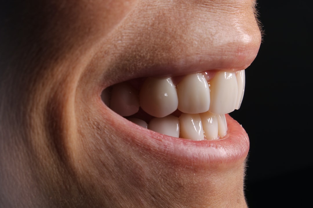 Gum tissue treatment at DC Pearls Dental Boutique