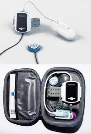 WatchPAT 300 home sleep apnea test device