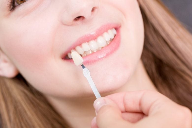 porcelain veneers can enhance the appearance of your smile