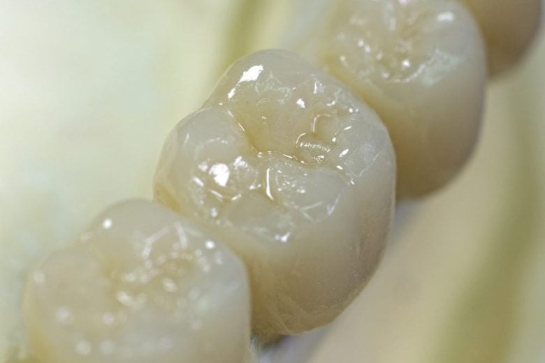 ceramic crowns can restore damaged teeth