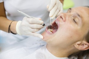 Person sitting while a dentist puts dental tools in their mouth